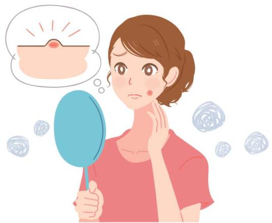 大人にきび